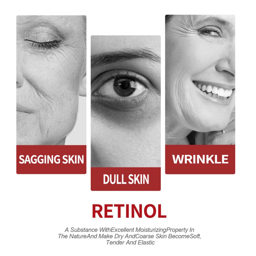 OUHOE Gentle Retinol Cream: Daily Care for Soft, Radiant Skin - Image 3