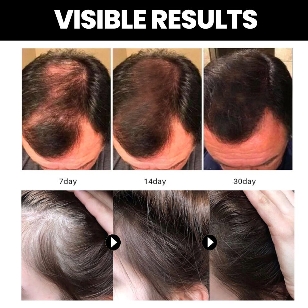 OUHOE Natural Batana Essential Oil for Daily Hair & Skin Care - Image 3