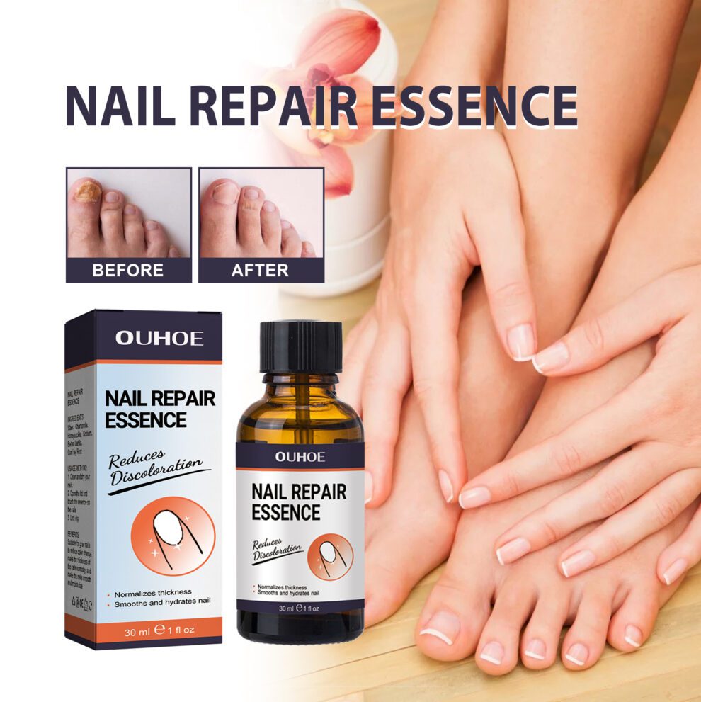 OUHOE Natural Nail Care Essence - Gentle Daily Nourishment - Image 2