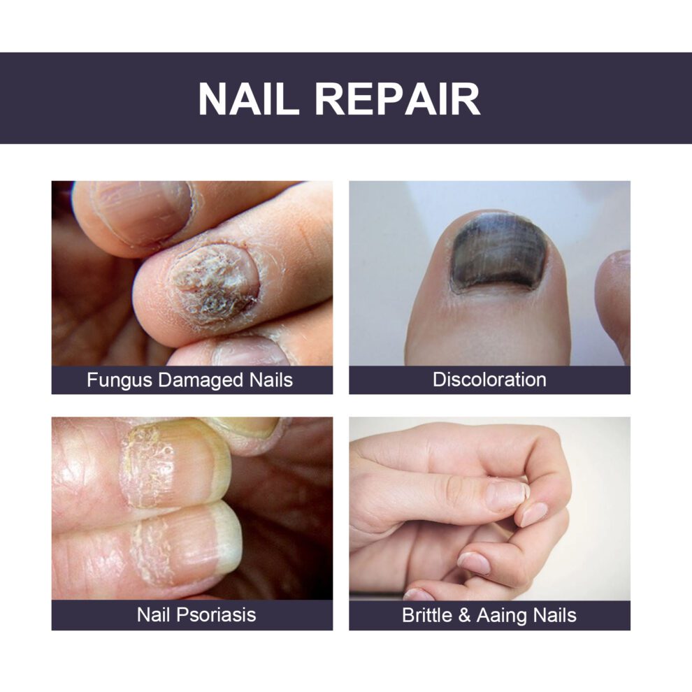 OUHOE Natural Nail Care Essence - Gentle Daily Nourishment - Image 3