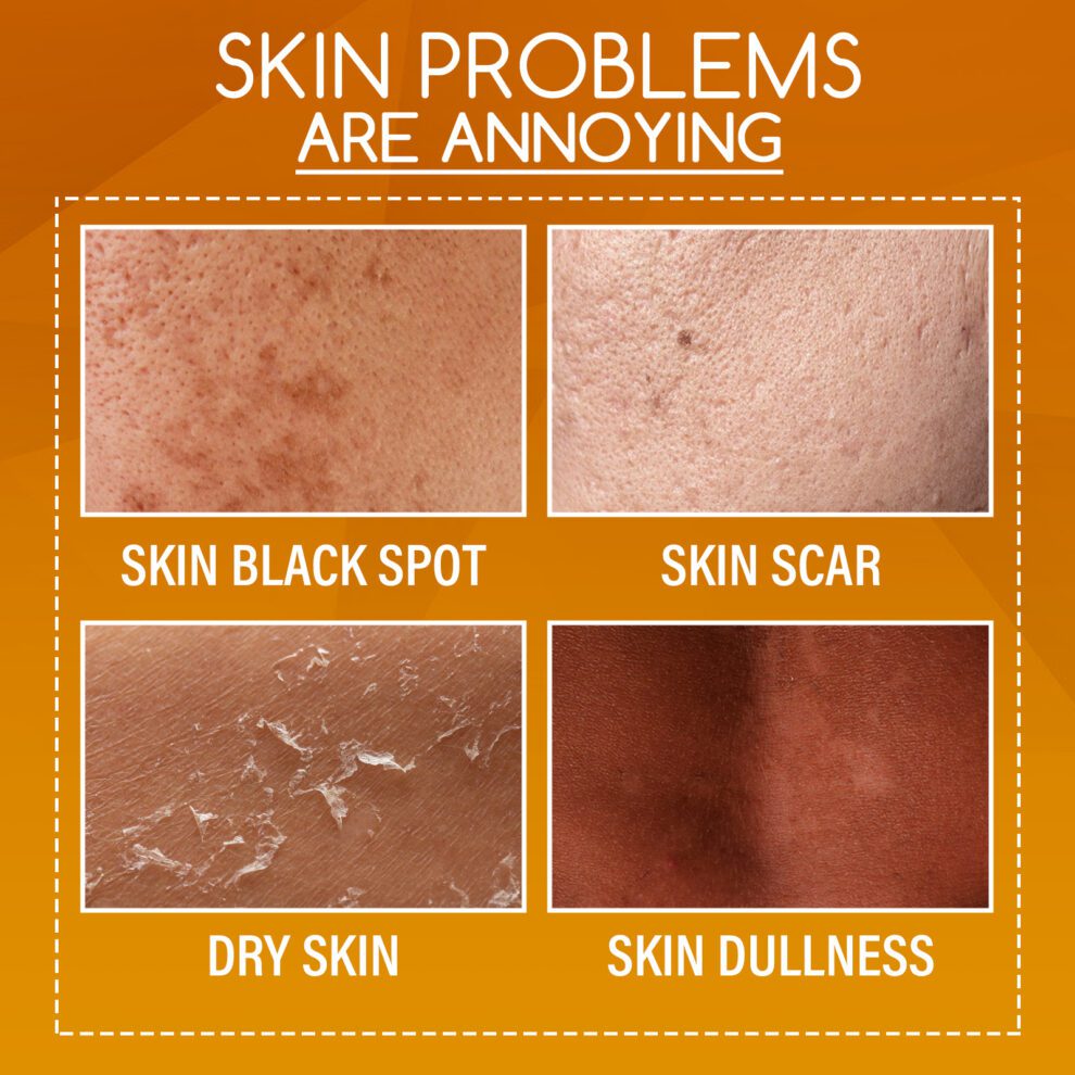 OUHOE Natural Orange Peel Body Lotion - Daily Glow & Moisturize - Image 3