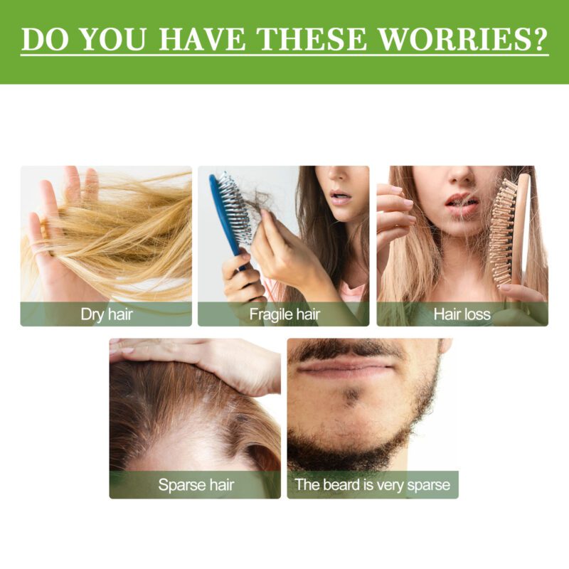 OUHOE Rosemary Hair Oil - Gentle Daily Care for Shiny, Healthy Tresses - Image 3