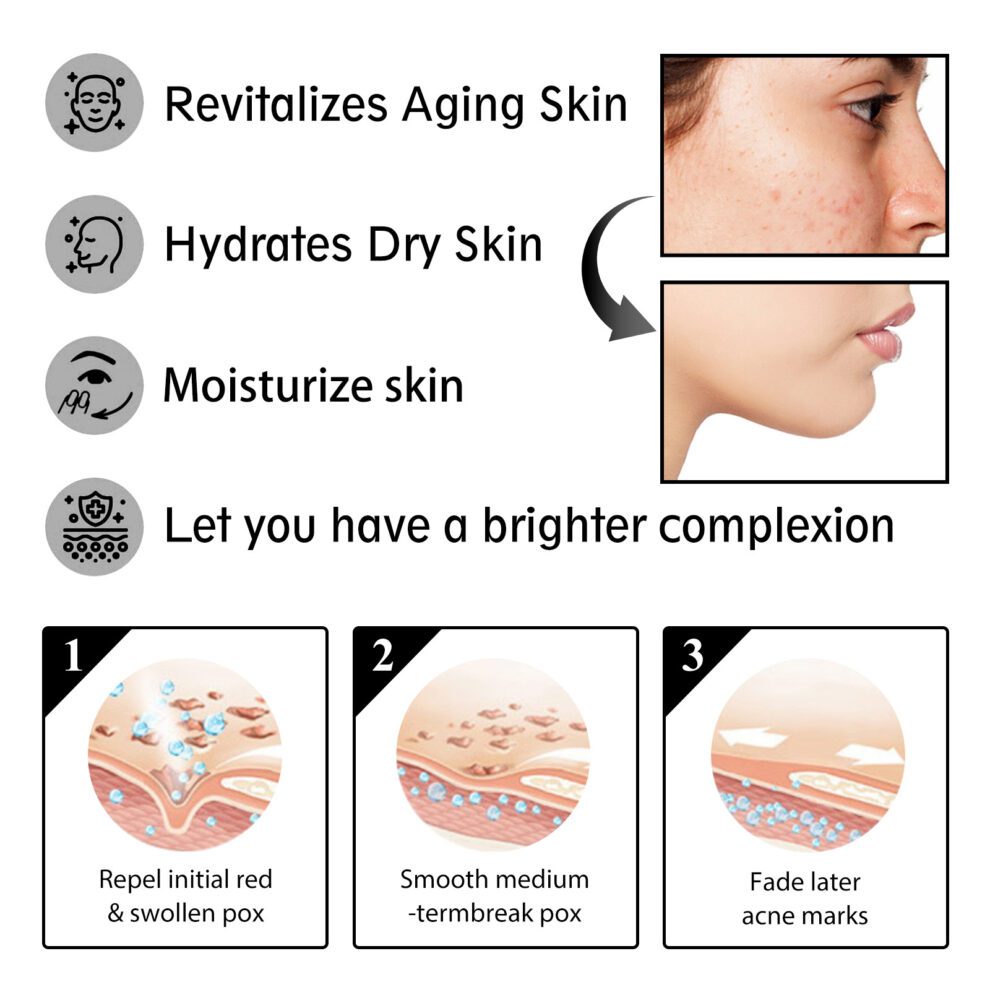 OUHOE Snail Cream - Gentle Daily Care for Soft, Glowing Skin - Image 4