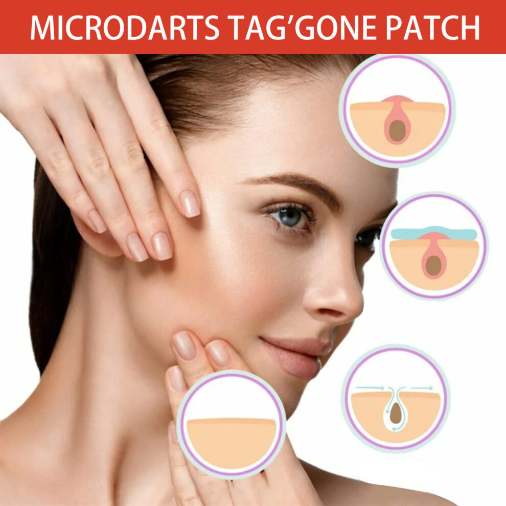 OUHOE Tea Tree Calendula Acne Spot Patch - Gentle Daily Care - Image 4