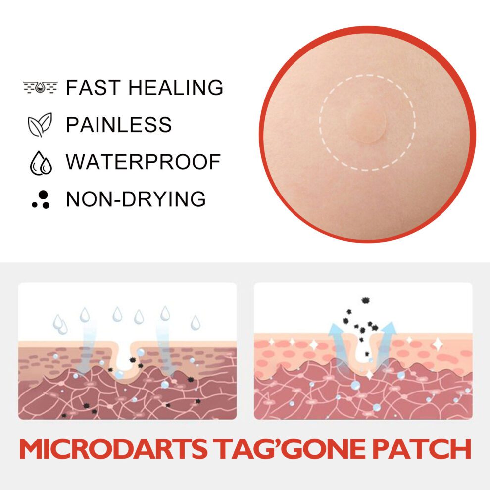 OUHOE Tea Tree Calendula Acne Spot Patch - Gentle Daily Care - Image 6