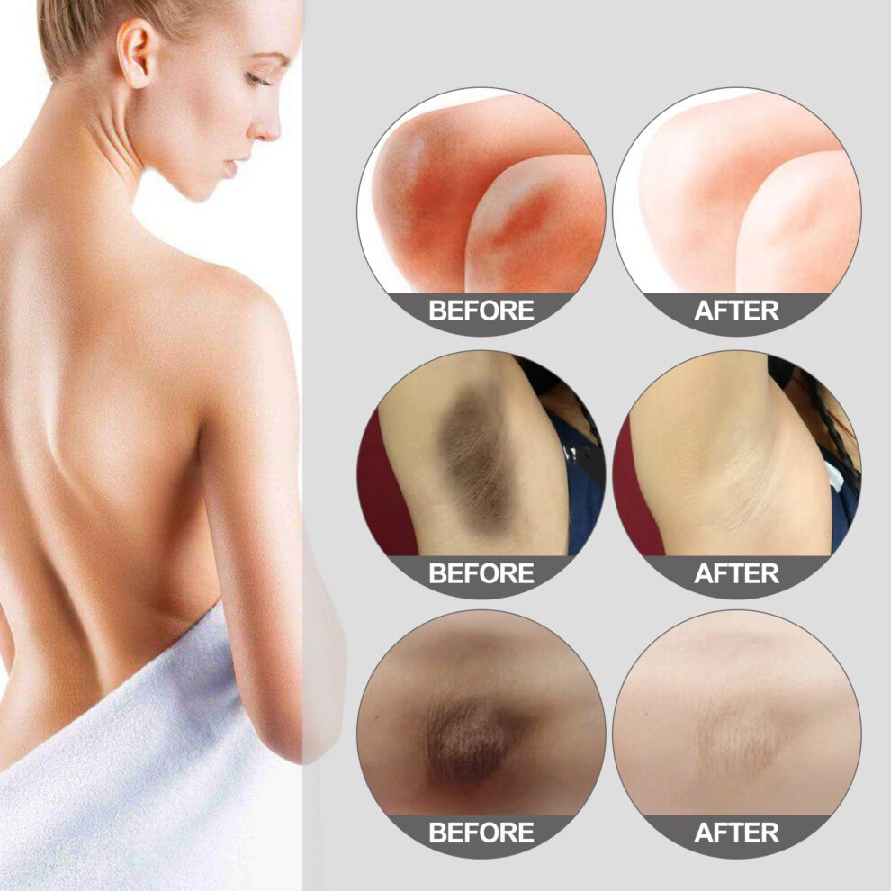OUHOE Thigh Brightening Moisturizer: Gentle Daily Care for Soft, Smooth Skin - Image 4