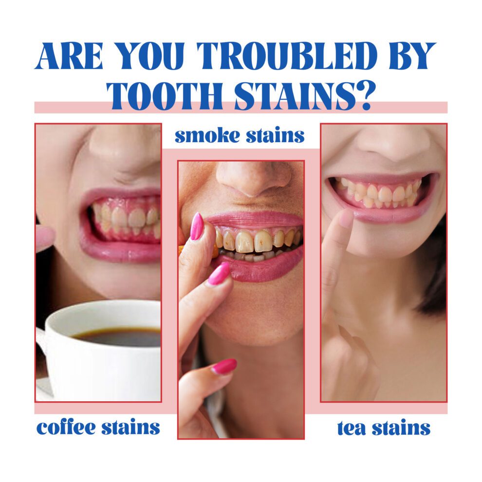Oralhoe Probiotic Toothpaste: Daily Fresh Smile & Natural Shine - Image 4