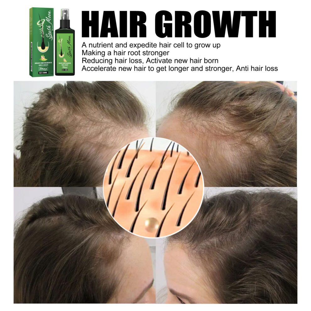South Moon Gentle Hair Spray - Natural Daily Scalp Nourish Care - Image 5