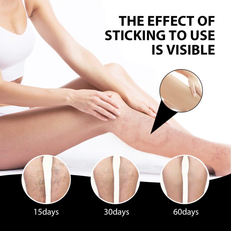 South Moon Ice Silk Foot Pads: Natural Daily Care for Happy Steps - Image 3