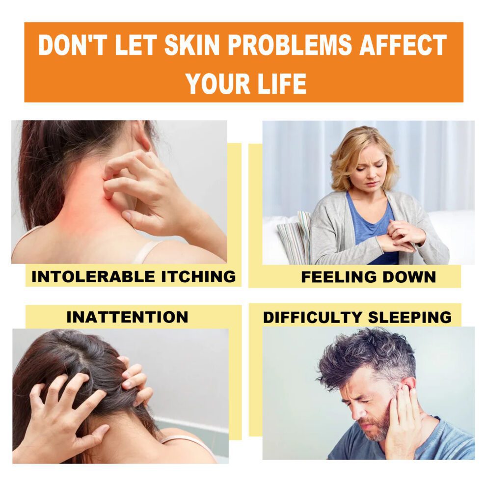 South Moon Natural Bee Venom Cream - Soothe Itchy Daily Care - Image 3