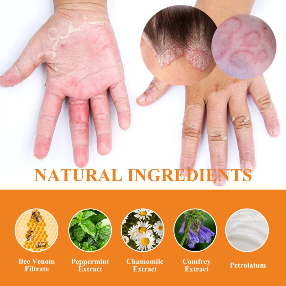 South Moon Natural Bee Venom Cream - Soothe Itchy Daily Care - Image 5