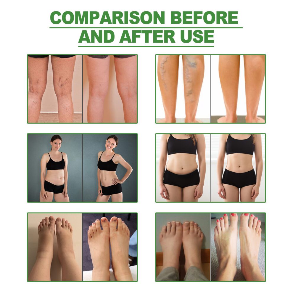 South Moon Natural Foot Patches (10pcs) Daily Soothe & Moisturize - Image 3