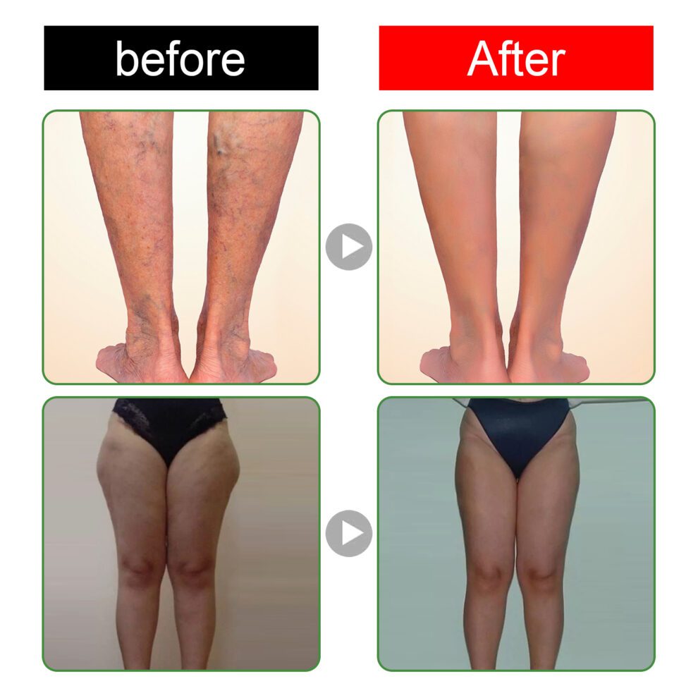 South Moon Natural Foot Patches (10pcs) Daily Soothe & Moisturize - Image 4