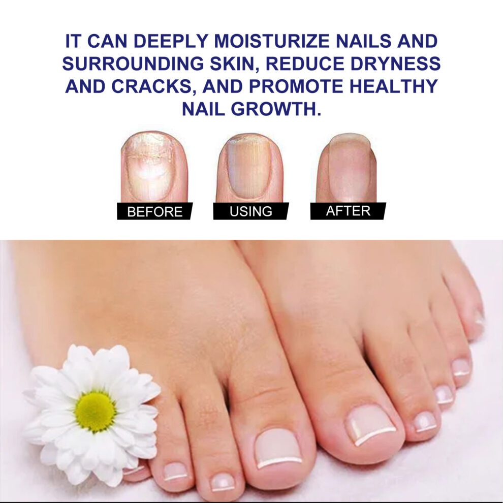 South Moon Natural Plant Drops - Gentle Daily Nail Care - Image 4