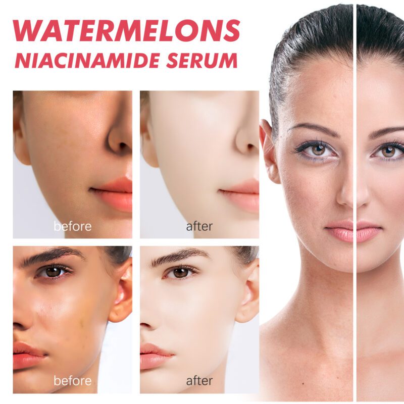 Watermelon Niacinamide Serum - Daily Glow Hydrating Essence - Image 3