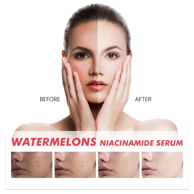 Watermelon Niacinamide Serum - Daily Glow Hydrating Essence - Image 4