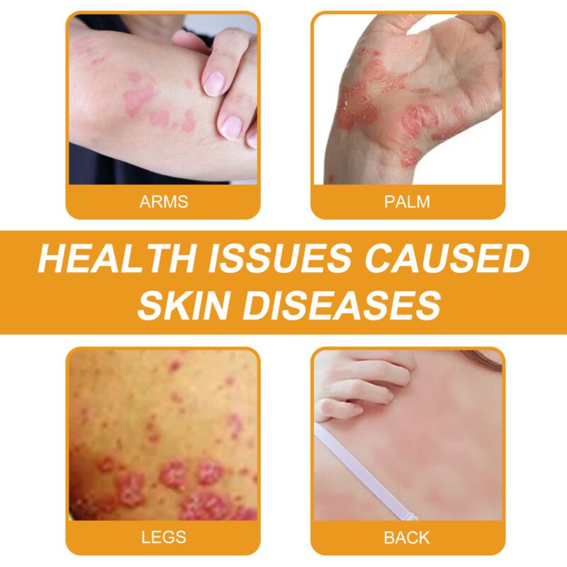 Wiyun BeesVenom Cowhide Moss Cream - Gentle Daily Skin Nurture & Moisture - Image 3