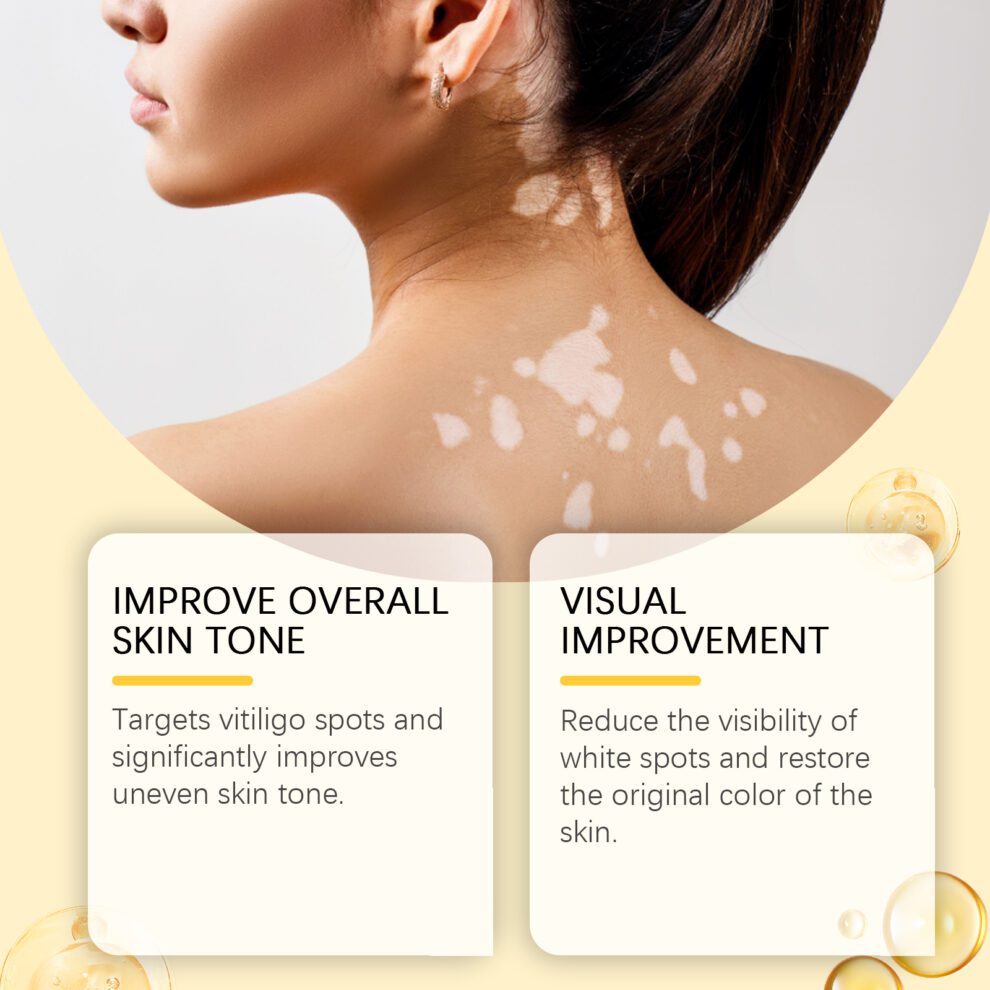 Ximonth Bee Venom Daily Care Cream - Nourish & Glow - Image 3
