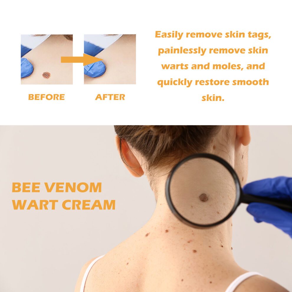 Ximonth Bee Venom Gentle Skin Cream - Natural Daily Care for Smooth - Image 3