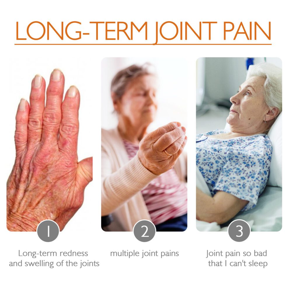 Ximonth Bee Venom Joint Cream - Gentle Daily Care for Soothing Comfort - Image 3