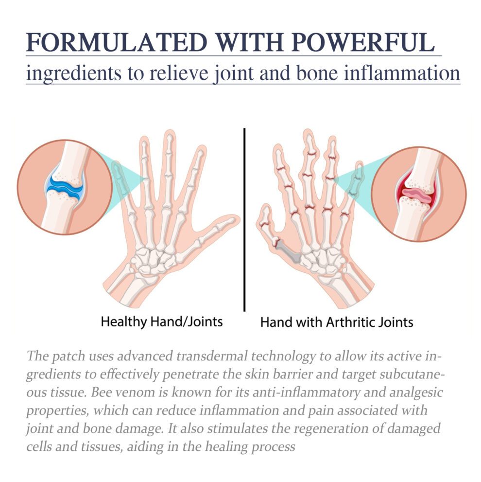 Ximonth Natural Bee Venom Cream: Joint Care & Gentle Relief - Image 4