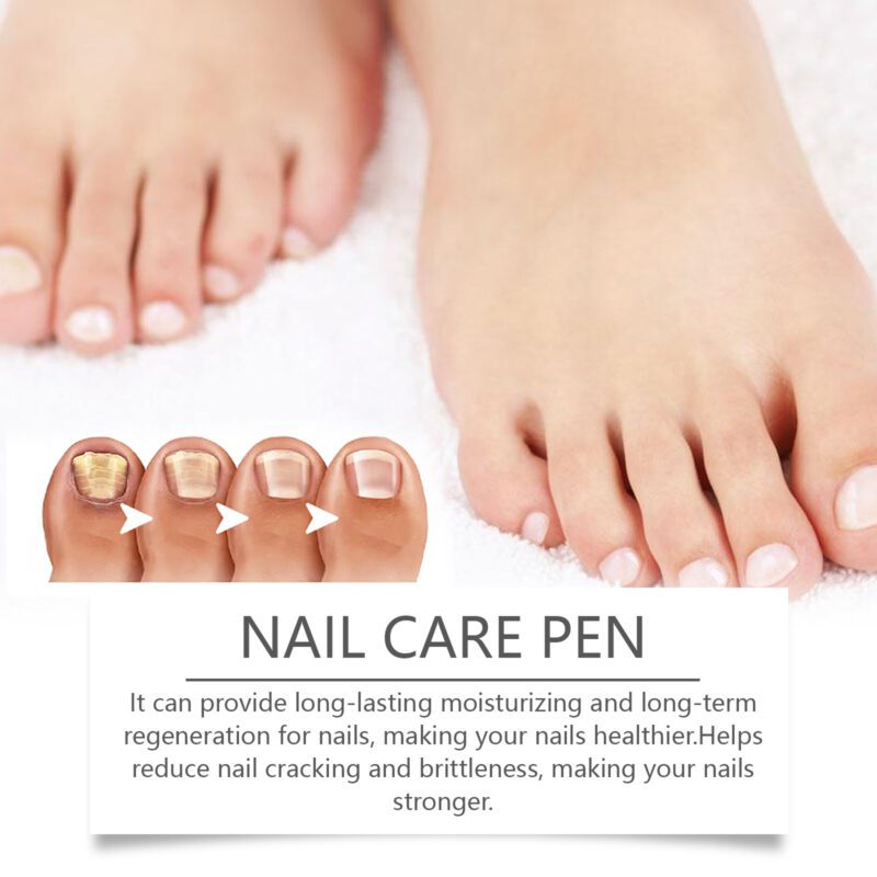 Ximonth Natural Nail Care Pen - Daily Care for Healthy Shiny Nails - Image 4