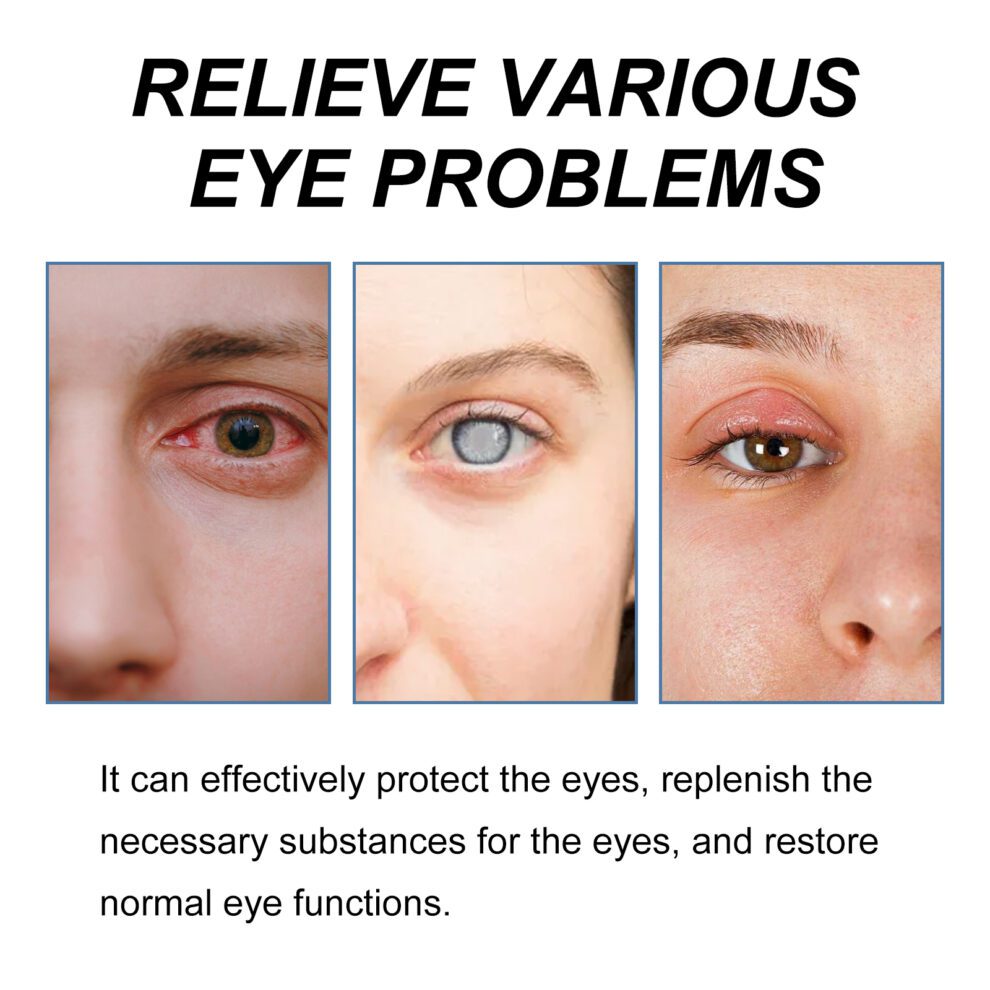 Ximonth Soothing Eye Drops - Natural Daily Care for Refreshed Eyes - Image 3