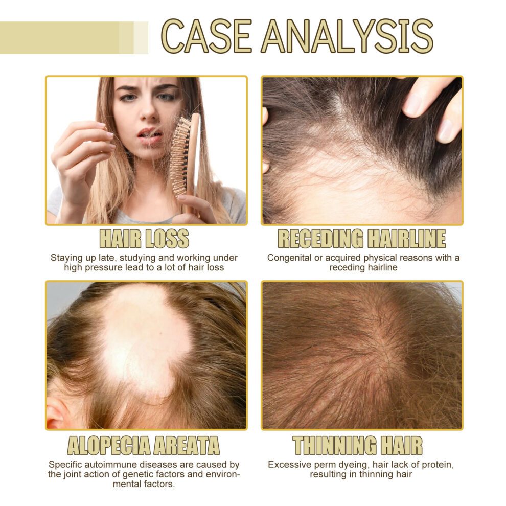 EELHOE Rosemary Hair Oil - Gentle Daily Care with Natural Goodness - Image 4
