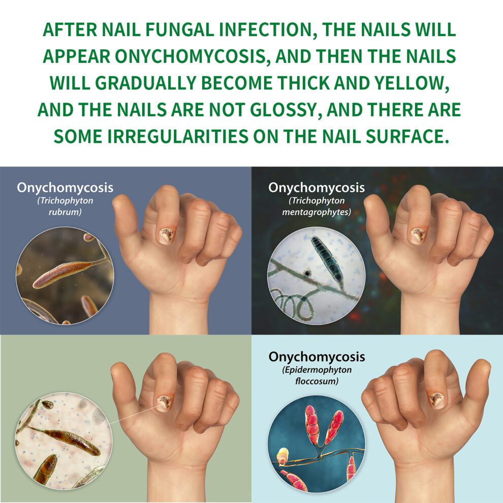 Jaysuing Ginger Nail Balm - Daily Care for Soft, Shiny Nails - Image 3