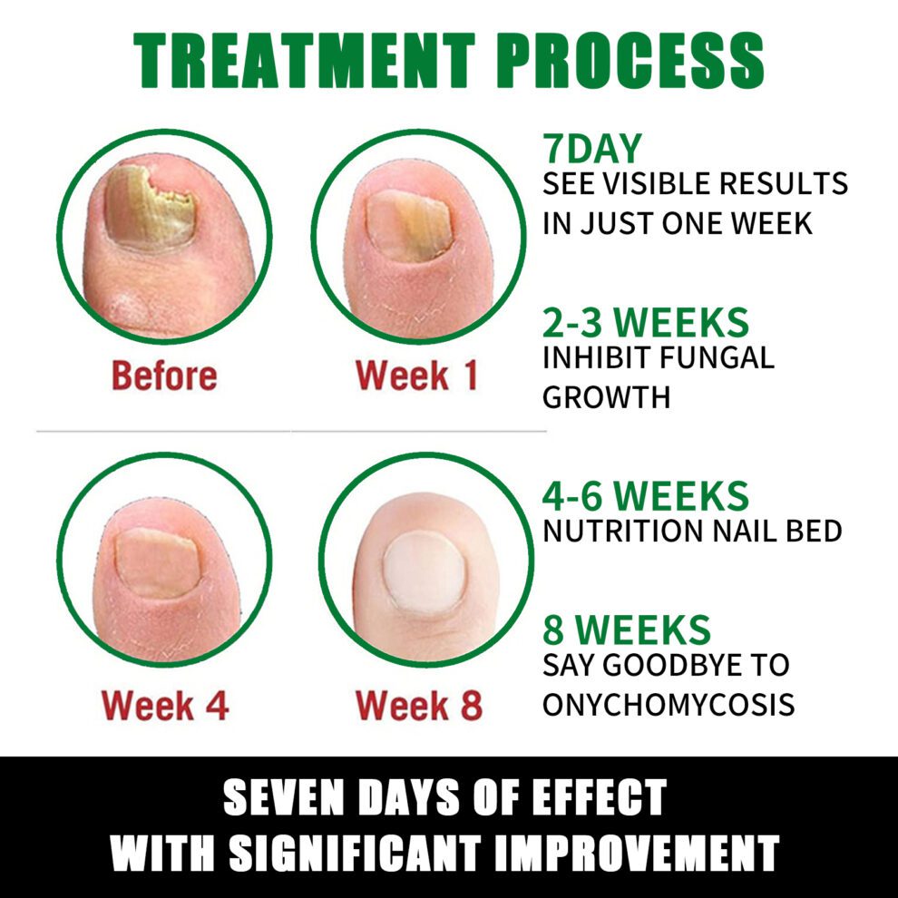 Jaysuing Ginger Nail Balm - Daily Care for Soft, Shiny Nails - Image 5