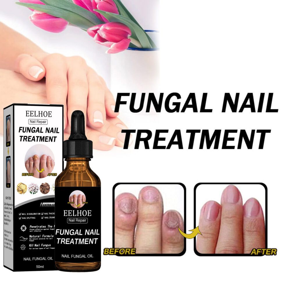 EELHOE Natural Nail Care – Daily Nourish for Healthier, Happier Nails - Image 3