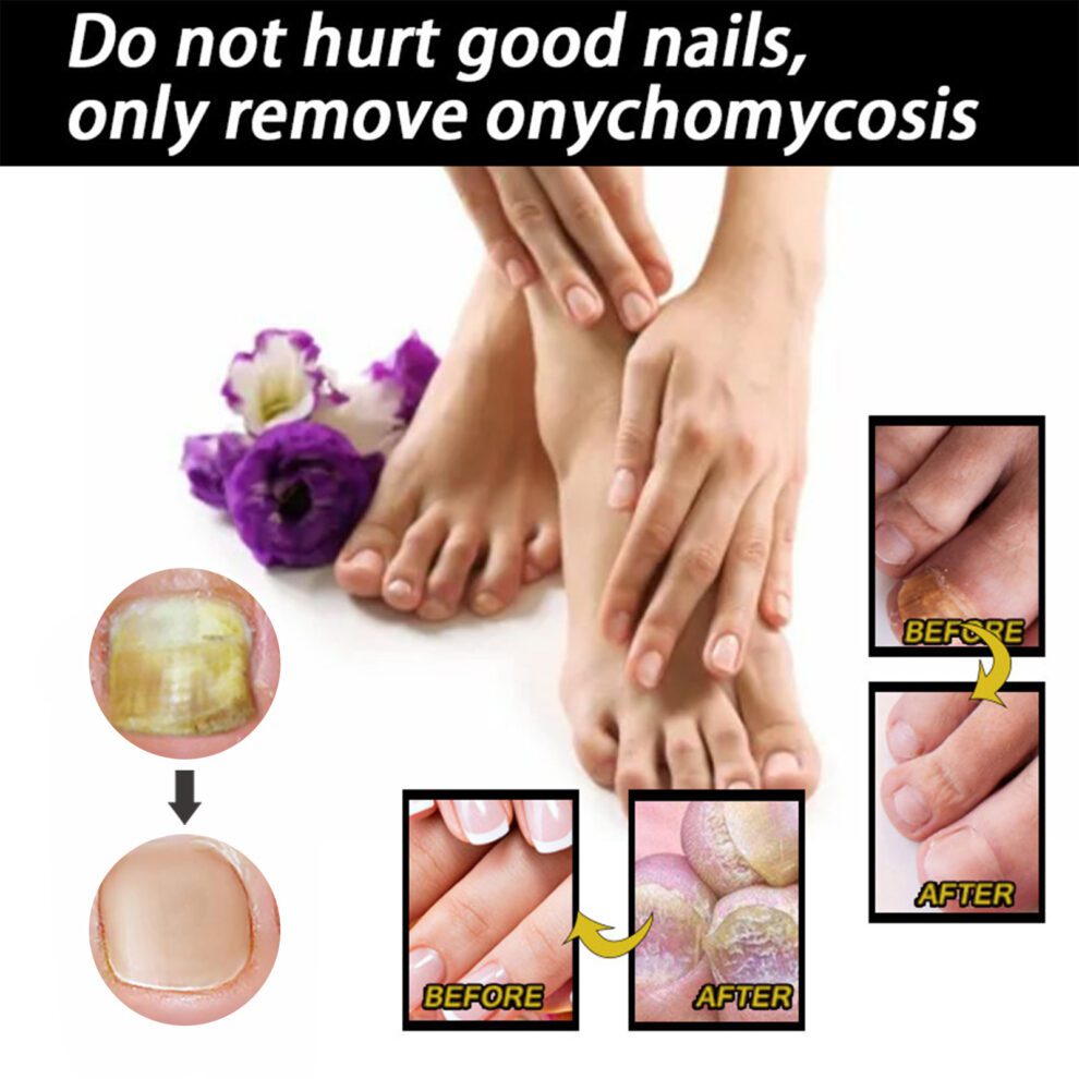 EELHOE Natural Nail Care – Daily Nourish for Healthier, Happier Nails - Image 5